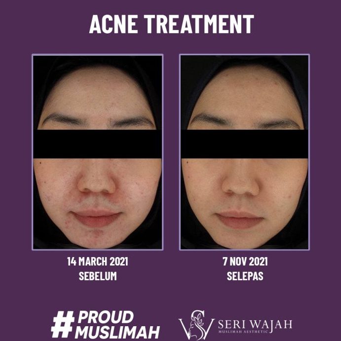 seri wajah muslimah facial spa batu pahat 1